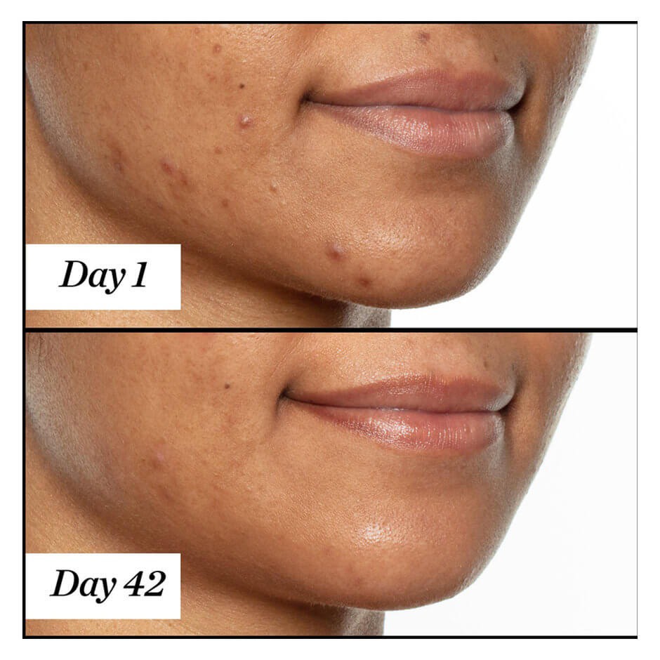 SUNDAY RILEY 💙 Dầu dưỡng cho da mụn nhạy cảm U.F.O. Ultra-Clarifying Face Oil | BigBuy360 - bigbuy360.vn