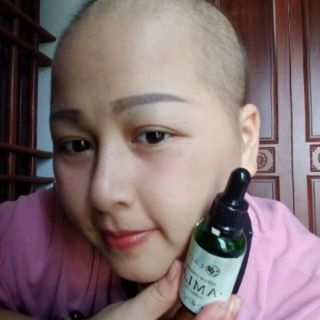 Bộ 3 dầu gội Amla kích thích mọc tóc