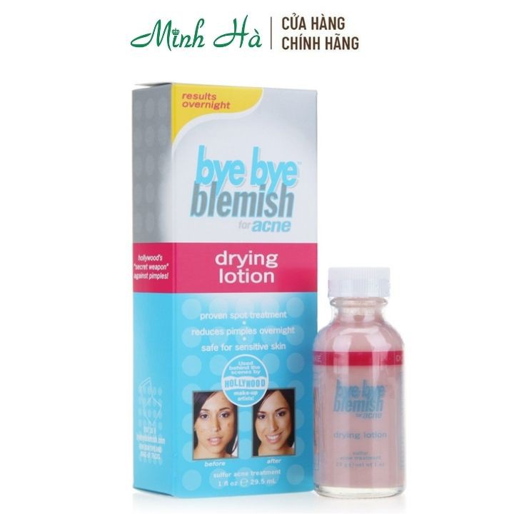 Dung dịch chấm mụn Bye Bye Blemish Drying Lotion 29.5ml