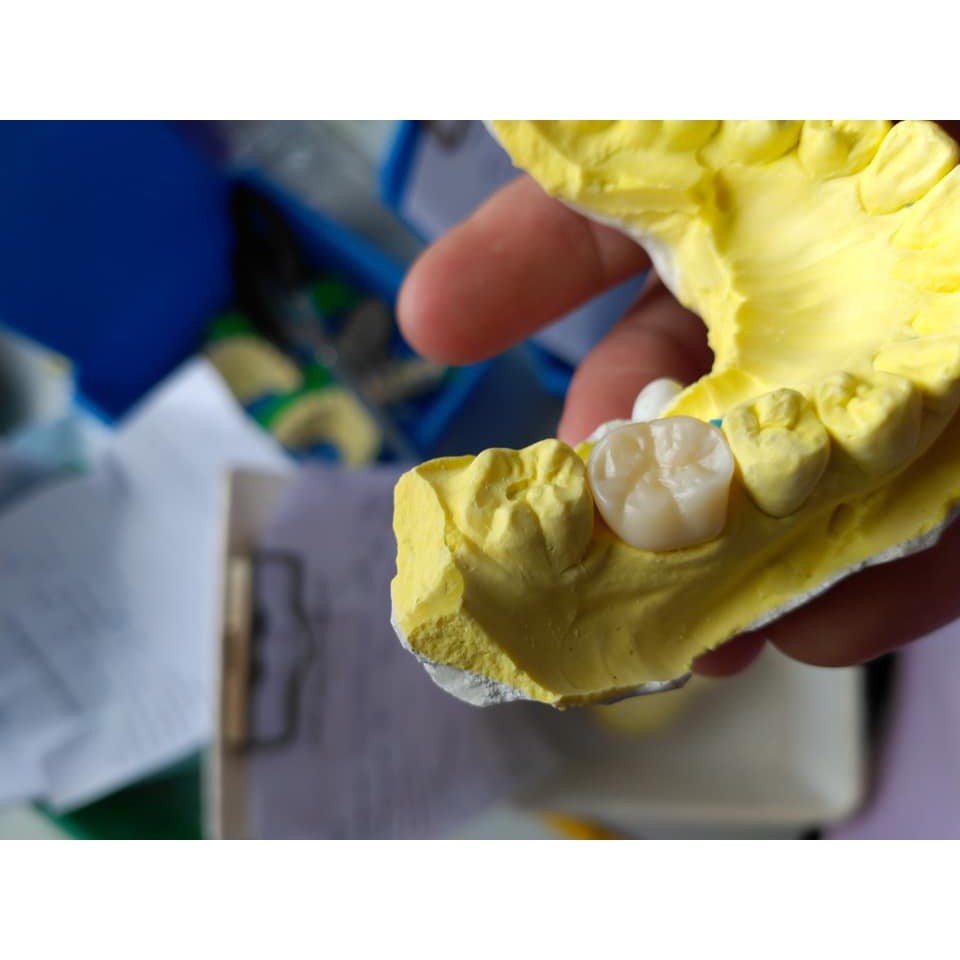 Phôi sứ Zirconia ST sản xuất răng CADCAM