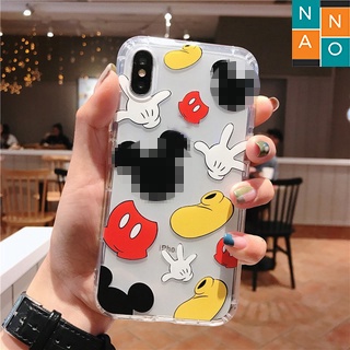 Ốp Lưng Iphone Trong Suốt Chống Sốc, Hình Mickey Dễ Thương 7plus,8Plus,x,xs,xsmax,11,11promax,12,12promax,13,13promax