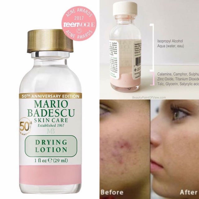 Chấm mụn Mario Badescu Drying Lotion thần thánh