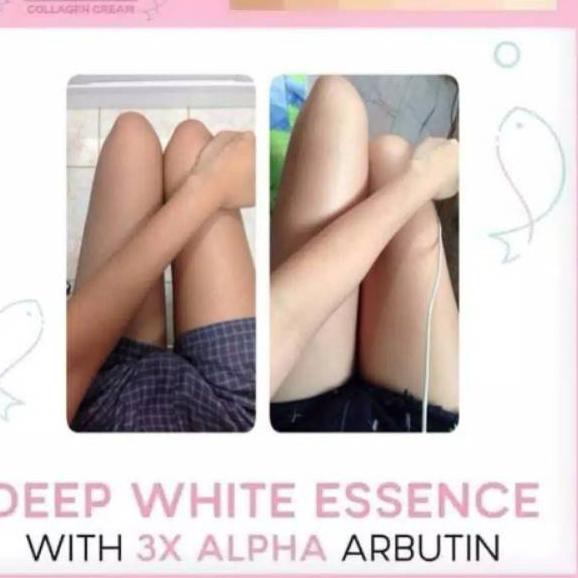 (Hàng Mới Về) Xà Phòng Collagen Làm Trắng Da Alpha Arbutin 3 Plus
