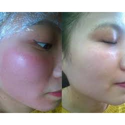Mặt nạ SMAS Peptide Silk Mask 24H Hydration Boost-Làm Dịu, Phục Hồi Da Nhạy Cảm, Treatment