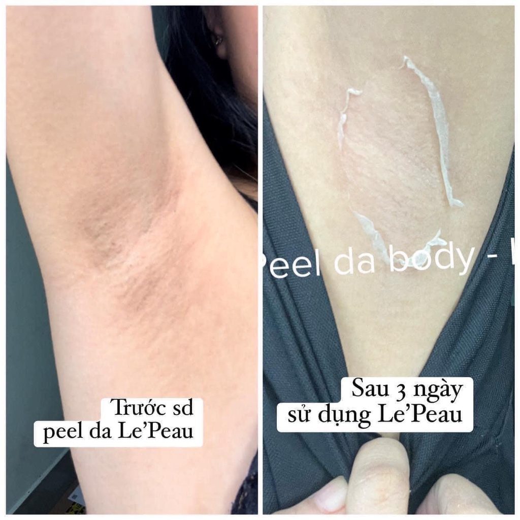 [CHÍNH HÃNG] Kem Peel Da Body Le'Peau 150gram - Trắng Da Mờ Thâm Sau 7 Ngày.