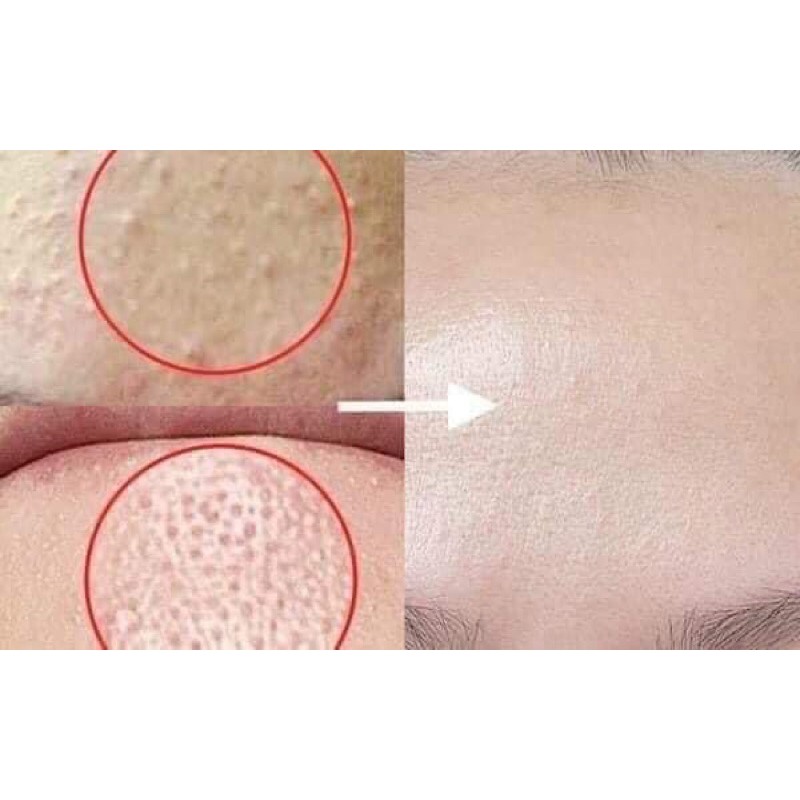 Kem dưỡng retinal reti A  Dr. different 0,05 0,1 0,12 % trẻ hoá da ngừa mụn