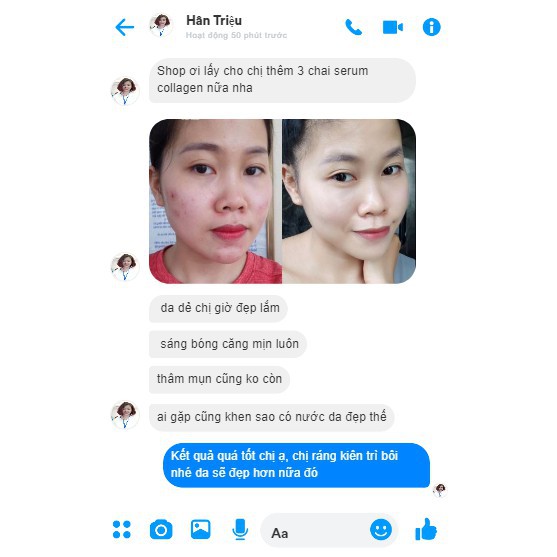 Loren Collagen Serum giúp xóa mờ các nếp nhăn và nâng cơ da mặt, làm trắng da chỉ sau 2 tuần sử dụng | BigBuy360 - bigbuy360.vn