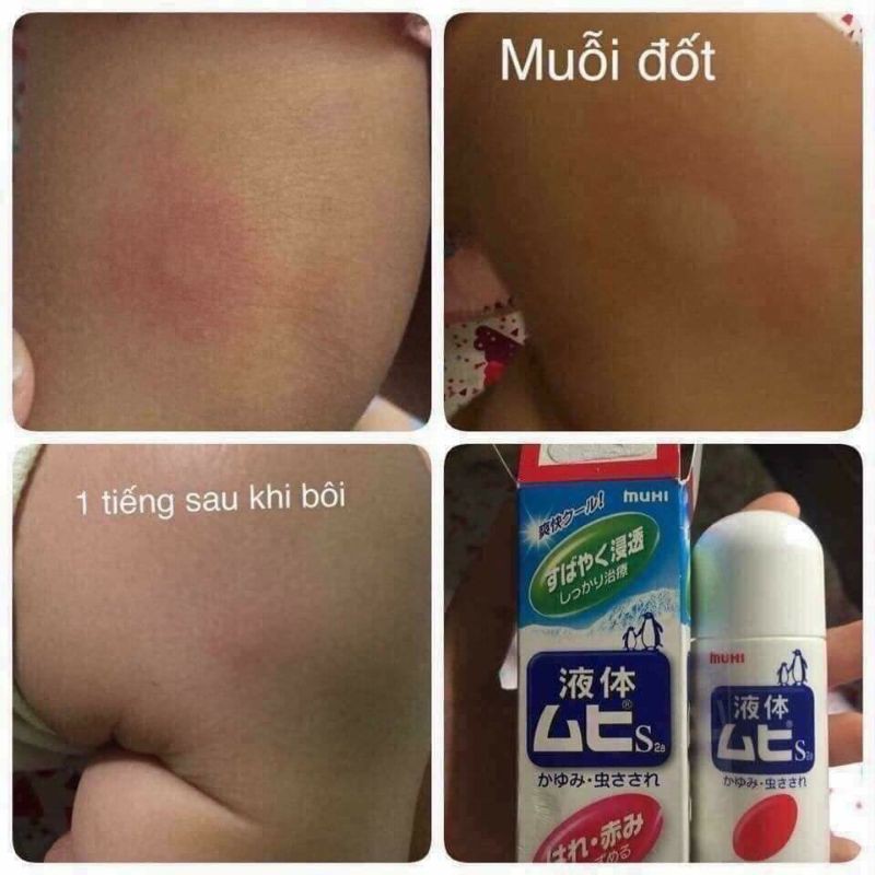 Thanh lăn Muhi giảm ngứa muỗi đốt và côn trùng cắn 50ml
