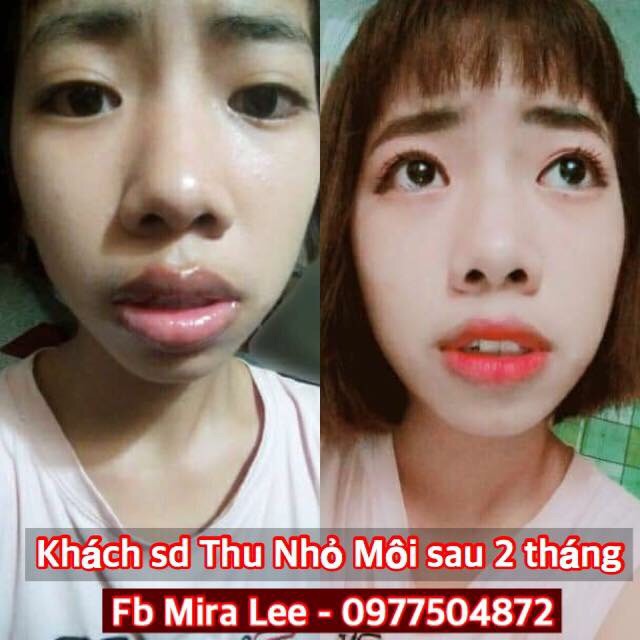 Tinh Chất Thu Nhỏ Môi Miracle