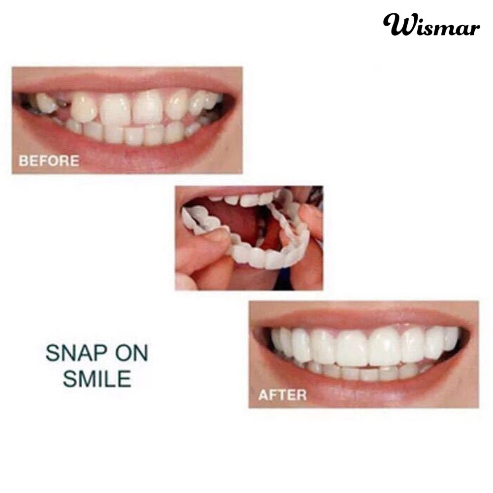 Bộ 2 hàm răng giả trên và dưới tiện lợi