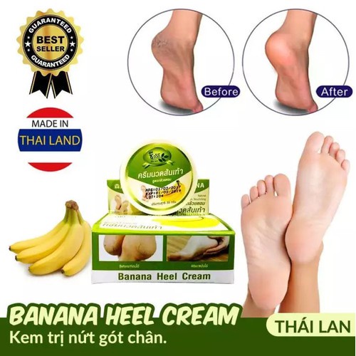 Kem Ngừa Nứt Gót Chân Banana Cream Heels 30ml