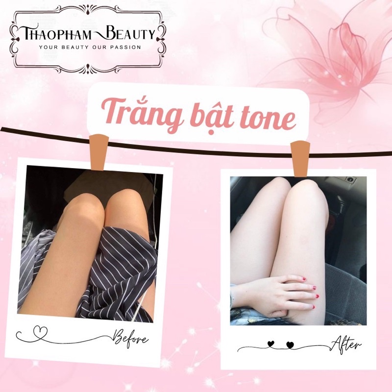 |GÓI SIÊU TIẾT KIỆM| COMBO SIÊU KÍCH TRẮNG MỜ THÂM CAO CẤP