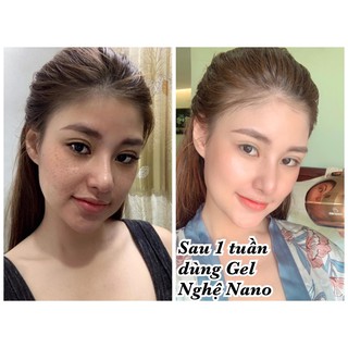 Mặt nạ ngủ nghệ Nano
