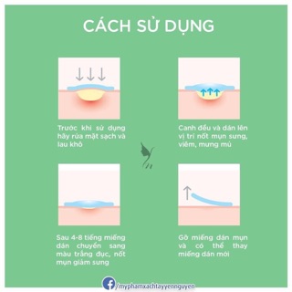 Miếng Dán Mụn Some By Mi Clear Spot Patch 18 Miếng