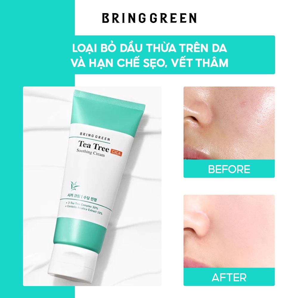 Kem Dưỡng Giảm Mụn Làm Dịu Da Tràm Trà Bring Green Tea Tree Cica Soothing Cream 100ml