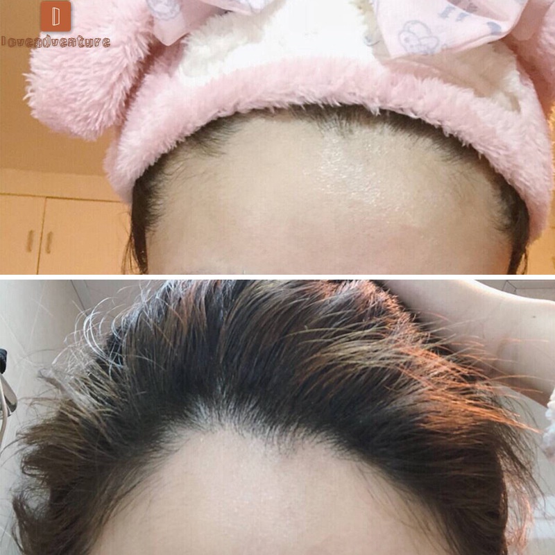 (Hàng Mới Về) Phấn Che Khuyết Điểm Chân Tóc Nhanh Chóng Gồm 4 Màu Sắc Tùy Chọn | BigBuy360 - bigbuy360.vn