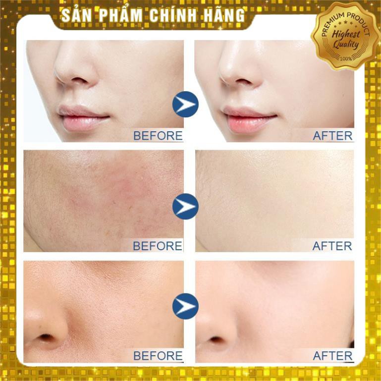 Serum Vàng 24k Và Trứng Cá Muối Hữu Cơ Làm Trắng Da Chống Lão Hóa 30ml | BigBuy360 - bigbuy360.vn