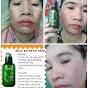 Serum Thay Da Nhân Sâm MQSKIN Chính Hãng Ginseng Repair Serum MQSKIN