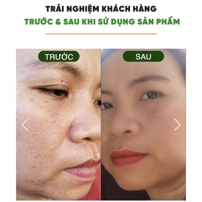 SIÊU VI TẢO GREEN VITA RECOVERY SỨC MẠNH CHỐNG LÃO HÓA ĐẾN TỪ "BÍ THUẬT" NHẬT BẢN | BigBuy360 - bigbuy360.vn