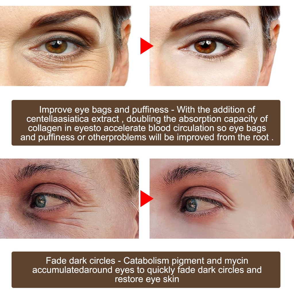 Kem dưỡng da mắt SUMAX chống lão hóa xóa mờ quầng thâm/ bọng mắt dưỡng ẩm hiệu quả 20g