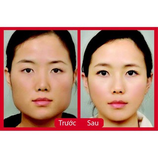 Miếng dán mặt thon gọn mặt V-line