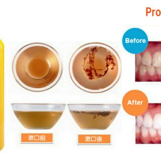 Nước súc miệng thần thánh Propolinse 600ml