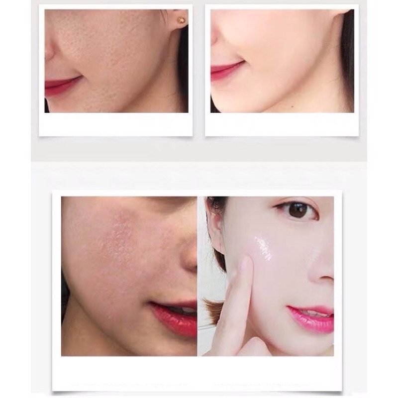 TONER XỊT Ủ MỤN GIÚP NGỪA MỤN BỌC MỤN TRỨNG CÁ toner verbenone rosemary | BigBuy360 - bigbuy360.vn