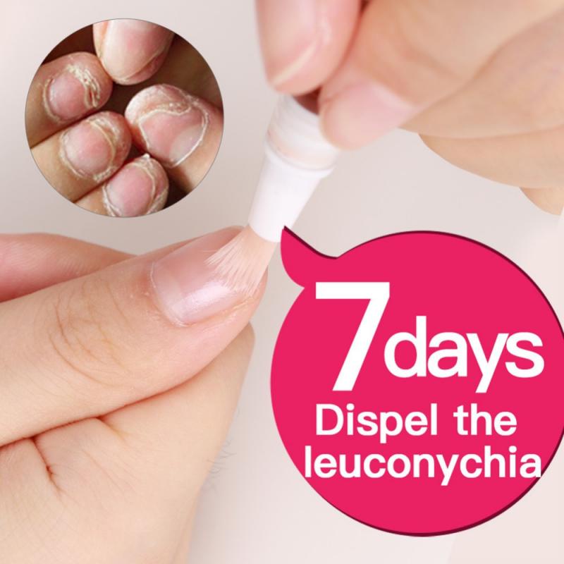 1 Cây Bút Dầu Trị Nấm Móng Tay / Móng Chân / Móng Chân Chăm Sóc Sức Khỏe Hiệu Quả 3ML