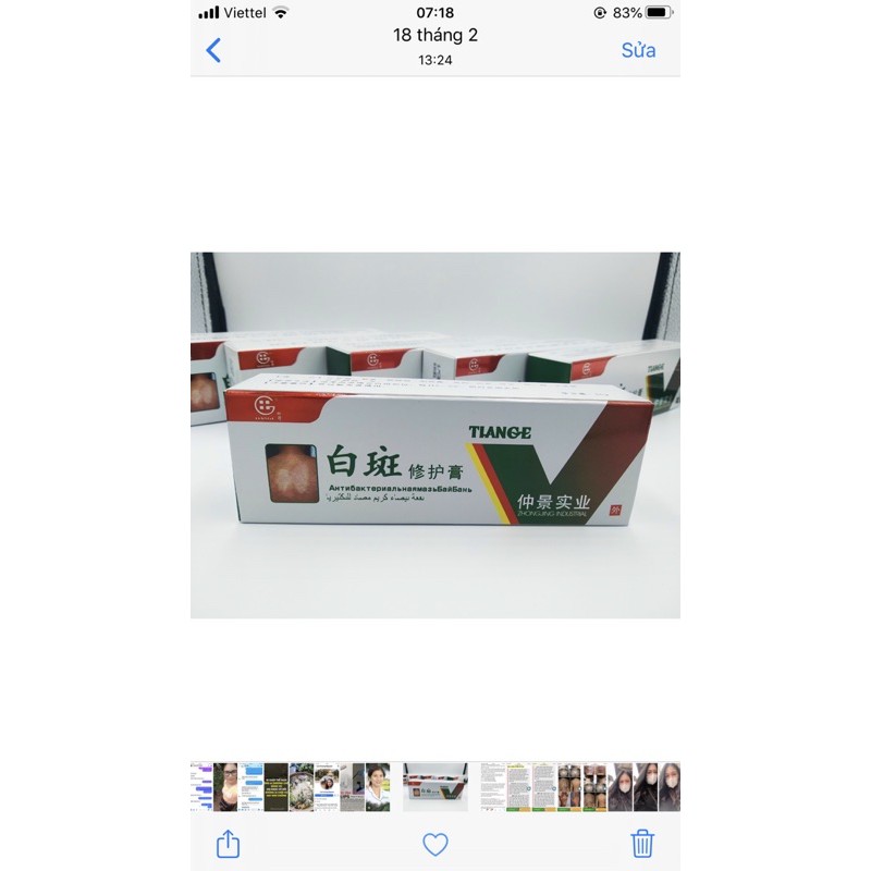 Thảo dược bôi bạch biến