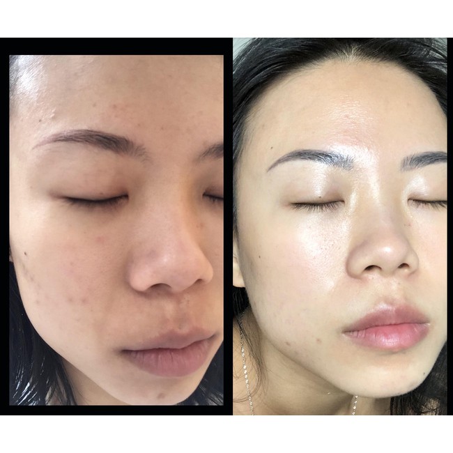 Bộ Kem Dưỡng Da DOCTOR MULGWANG MH Beauty Spa