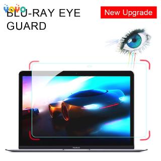 Miếng Dán Bảo Vệ Màn Hình Cho Macbook Notebook 13 Inch