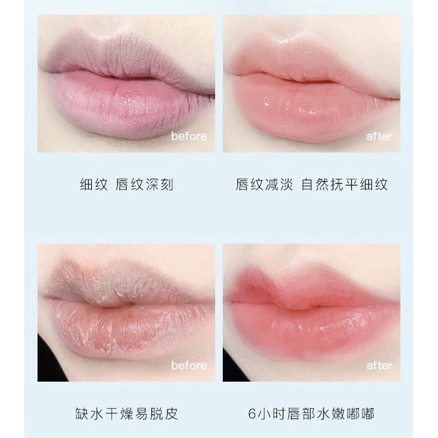 Hũ son dưỡng hồng môi Vaseline ADAD
