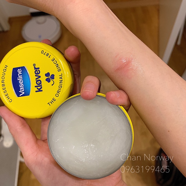 [TOP 1 SHOPEE] Vaseline Klover dưỡng ẩm Nauy 🇳🇴