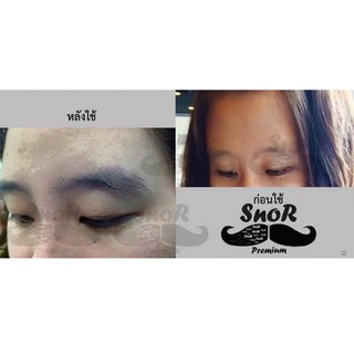 SNOR KÍCH THÍCH MỌC LÔNG RÂU