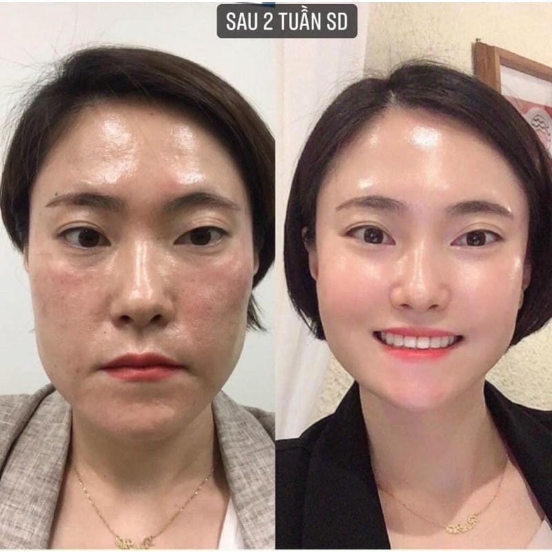 Serum sáng da, cải thiện sạm nám Ekseption Hyaluronic TRX mẫu mới 75ml