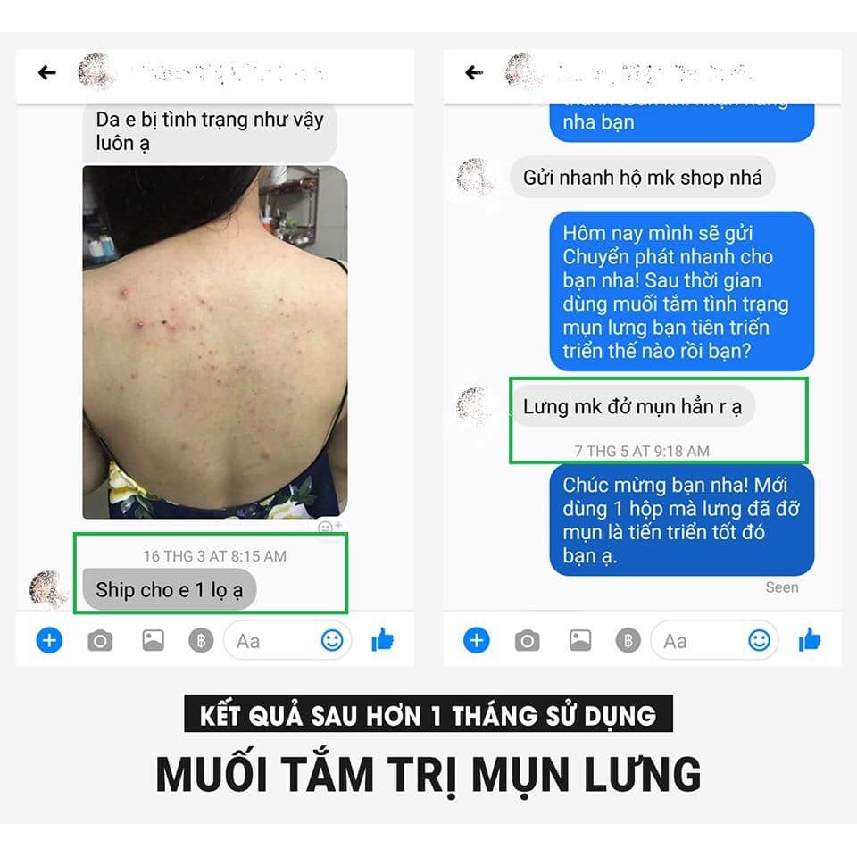 [HẾT MỤN LƯNG-VIÊM NANG LÔNG] Kết HợpTẩy Tế Bào Da Chết Body Với Muối Tắm Tinh Chất Sữa Non L'asenta | Thế Giới Skin Care