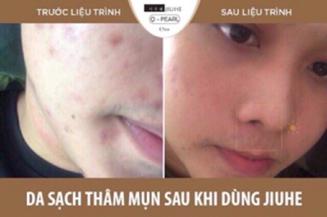 Kem dưỡng da Juihe Q – Pearl