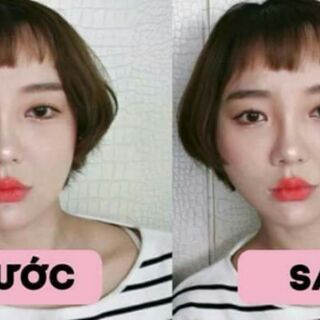 40 Miếng dán mặt Vline