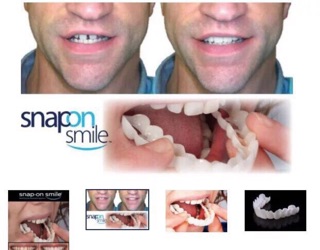 DỤNG CỤ BỌC RĂNG SILiCON SNAPON SMILE
