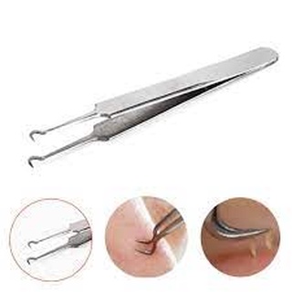 NHÍP GẮP MỤN THẦN THÁNH