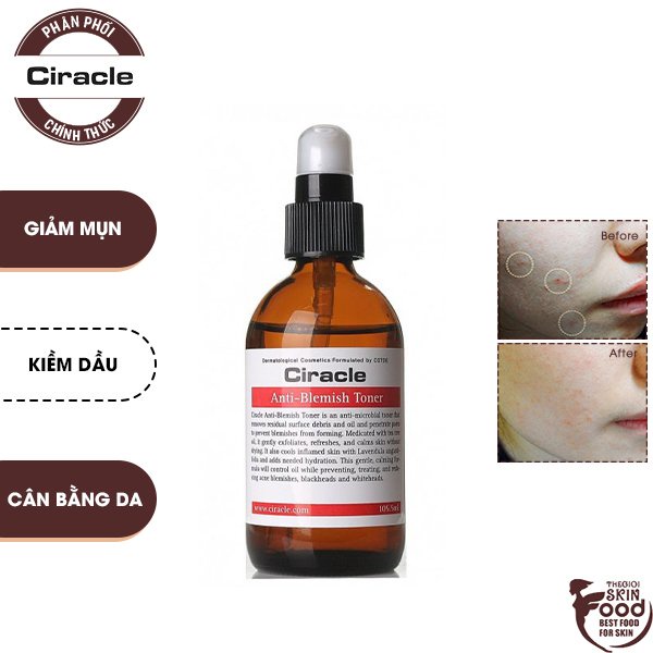 Nước Hoa Hồng Hỗ Trợ Giảm Mụn, Kiềm Dầu Ciracle Anti-Blemish Toner 105,5ml