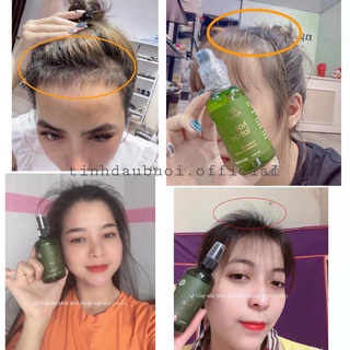 Combo 5 Chai Xịt Tóc Tinh Dầu Bưởi Giúp Mọc Tóc, Chăm Sóc Tóc