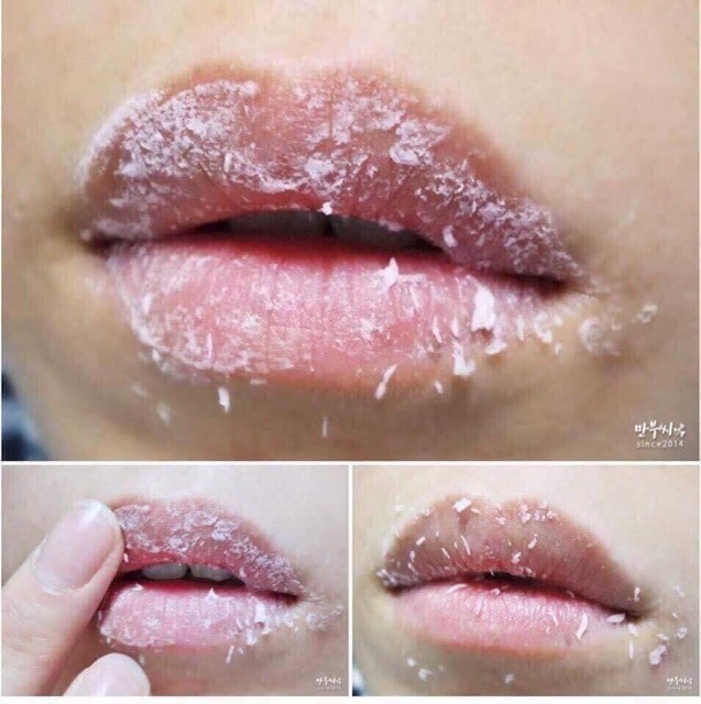 Ampoule dưỡng môi + Tẩy Tế bào chết môi Bubi Lips | BigBuy360 - bigbuy360.vn