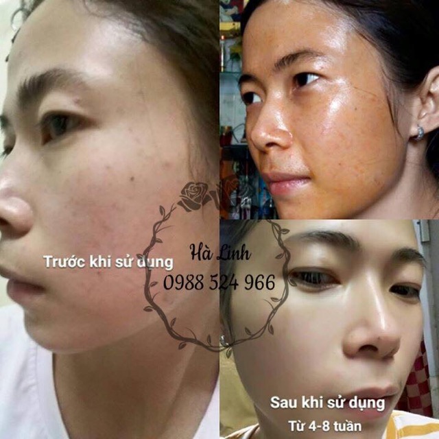 Tinh Dầu Gấc Nguyên Chất