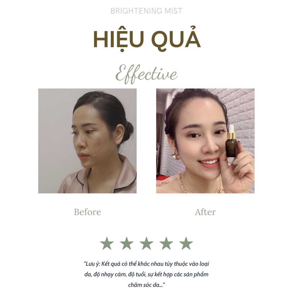 Serum nám tàn nhang V9Queen, tinh chất sáng da ngăn ngừa lão hóa - 9Day Revival 10ml