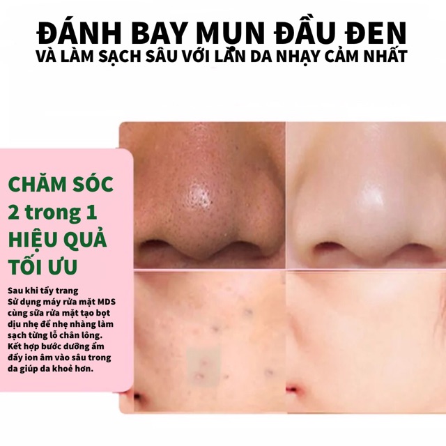 [CHÍNH HÃNG BH 1 ĐỔI 1] Máy rửa mặt / chăm sóc da đa chức năng MDS (Xanh Mint) - Bảo hành 1 đổi 1 trong 6 tháng | BigBuy360 - bigbuy360.vn