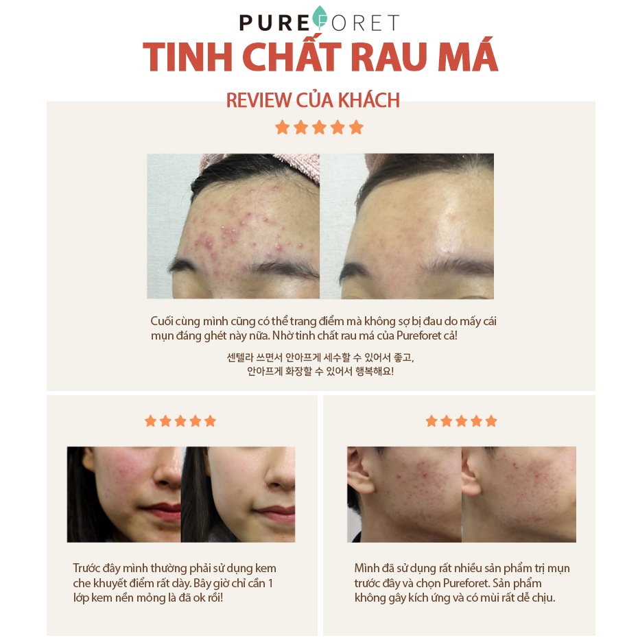 Cao rau má dành cho da mụn, da tổn thương - Centella Multi Balm Mini size 15G - Made in Korea