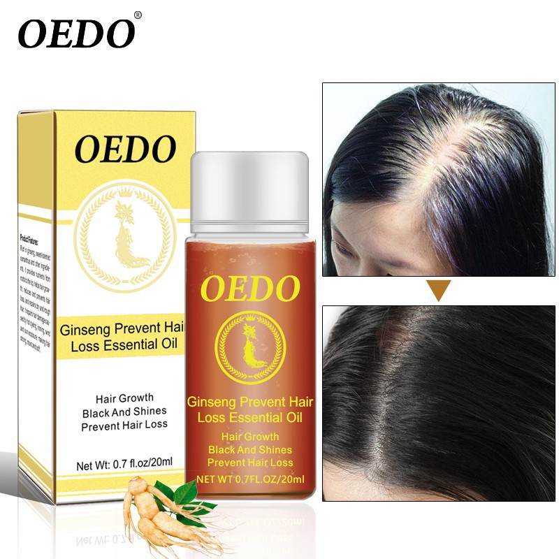 Tinh dầu kích thích mọc tóc OEDO 20ml | BigBuy360 - bigbuy360.vn