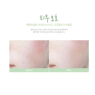 Tinh Chất Cho Da Mụn Caryophy Ampoule 10ml