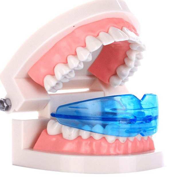 Dụng cụ niềng răng tại nhà an toàn, chất lượng